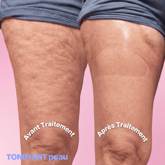 Tonaali - PatchLift
